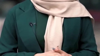 کارخانه قالیشویی نصیری یزد برداشتن زگیل