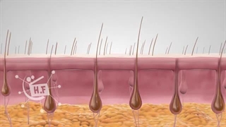 دستگاه لیزر تجهیزات پزشکی مدکالا