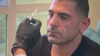 تزریق بوتاکس در کلینیک رژوه