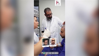 زراعة شعرکم بسعر لا یصدق _ زراعة الشعر فی جلسة واحدة