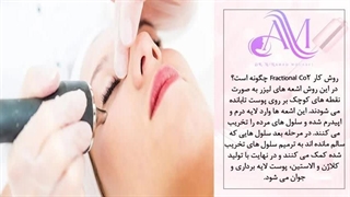 میدونی لیزر co2 فرکشنال چه مزایایی میتونه برات داشته باشه