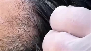 پزشک زخم در تبریز