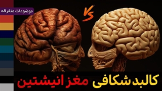 تفاوت مغز انیشتین با افراد عادی چه بود ؟