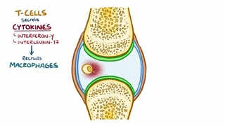 مجموعه آموزشی روماتولوژی اسموزیس (osmosis)