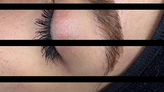 قرینه سازی ابرو بدون زخم و فیبروز