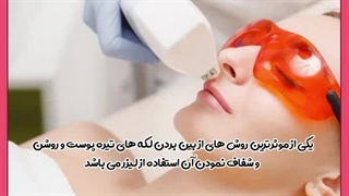 لیزر روشن کننده پوست رفع غبغب