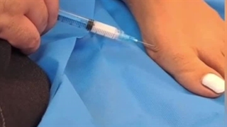 آرتروز انگشت شست پا . دکتر بهرام بدوحی . متخصص ارتوپد کلینیک درد مهرگان ترمیم زیبایی دندان