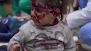 به لرزش دستاش و بدنش نگاه کن  دندوناتو رو هم فشار بده و از باعث و بانیش کینه بگیر و توی دلت نگه دار تا وقتش