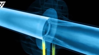 فیلم نحوه عملکرد اوریفیس فلنج