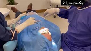 جراحی سینوس و کاشت ایمپلنت spi