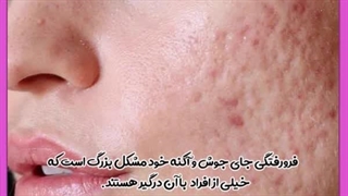 درمان اسکار جای جوش دکتر پوست