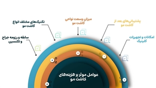 عوامل موثر بر هزینه‌های کاشت مو+| 5 مورد بسیار مهم |