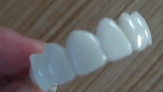 لمینت متحرک دندان دیجی کالا یا دوپکا بخریم یا نخریم