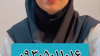 پیسی داری تتو بزن ویتیلیگو ویتیلایگو برص بهاق vitiligo