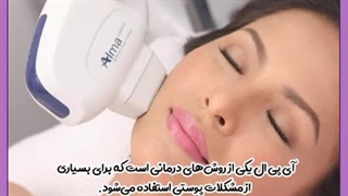 لیزر آی پی ال تزریق بوتاکس