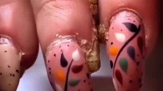 چه عواملی باعث به وجود اومدن پسوریازیس ناخن می‌شود Psoriasis