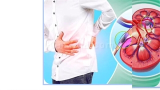 قویترین کرم ضد درد تسکین دهنده /09120750932