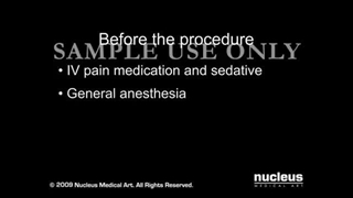 بای پس کلاسیک