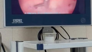 فیلم واقعی عمل برداشتن سپتوم رحم (دیواره رحم)