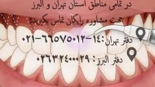 لبخند لثه ای