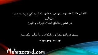 ایمپلنت دندان