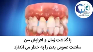 عوارض نامرتبی دندانها