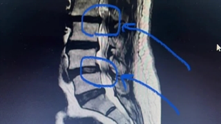 جراح بابک سیف زاده - رضایت بیمار عزیز