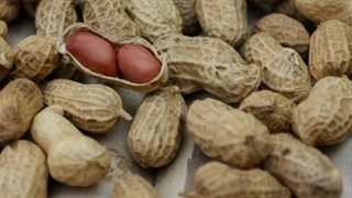 خواص آجیل برای زیبایی پوست و مو رفع غبغب