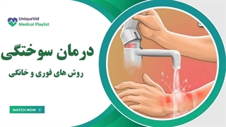 روشهای فوری درمان سوختگی