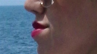 جراحی فک و ارتودنسی جلو بودن فک پایین