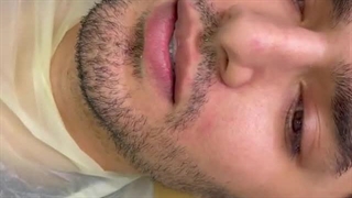 پالیش کامپوزیت دندان به چه صورت هست؟