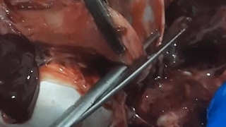 معده کپور معمولی