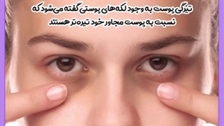 علت سیاه شدن ناگهانی پوست صورت هایفوتراپی
