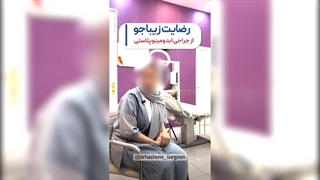 تجربه جراحی ابدومینوپلاستی خیلی عوض شدم | دکتر سید رسول هاشمی | رفع افتادگی پلک