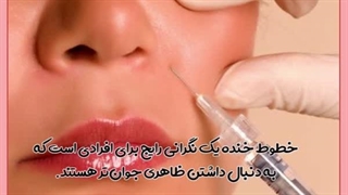 تزریق فیلر خط خنده کاشت مو