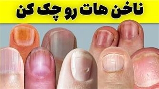 ۵ هشدار که ناخن های شما درباره سلامتی شما میدهند!