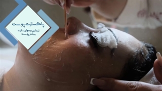 مراحل پاکسازی پوست در کلینیک سلامت ایده آل مشهد