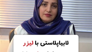 سوالات رایج لابیاپلاستی