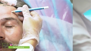 سلامت ایده آل ؛ بهترین کلینیک تزریق بوتاکس مشهد