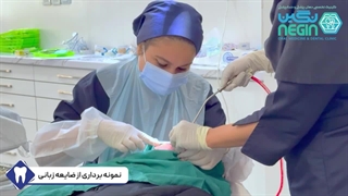 نمونه برداری از ضایعه زبانی - دکتر نگین اثنی عشری دندان پیش