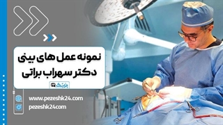 دکتر سهراب براتی بهترین جراح بینی در اصفهان