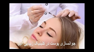 جوانسازی پوست در کلینیک زیبایی آنیل اکستنشن تاج دندان