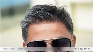 پروتز مو هندی