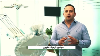 ایمپلنت فوری