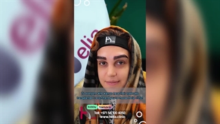 Eyebrow transplant: 98% satisfaction among applicants