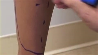 لیپوماتیک مچ پا