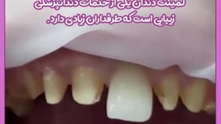 برداشتن ضایعات پوستی با لیزر