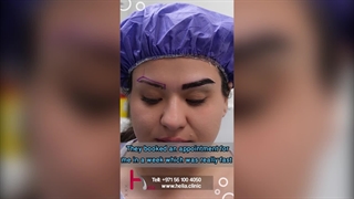 کاشت ابرو - تضمین تراکم و طبیعی بودن ابروها