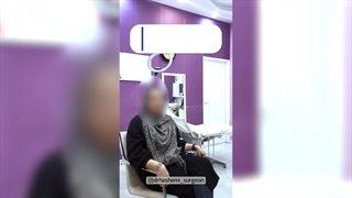 دکتر ، تمام استرس رو ازم دور کرد | دکتر رسول هاشمی | جراحی ابدومینوپلاستی