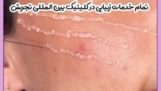 لیست کامل خدمات کلینیک زیبایی میکرونیدلینگ